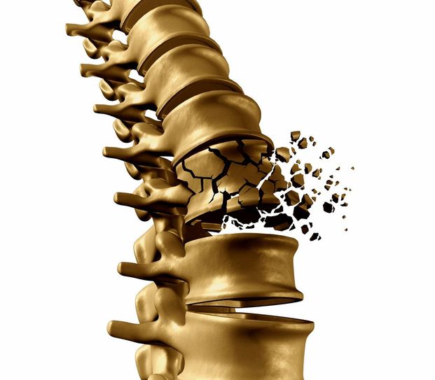 Experten informieren am Lesertelefon zu Risiken, Diagnostik und Vorbeugung der Osteoporose.