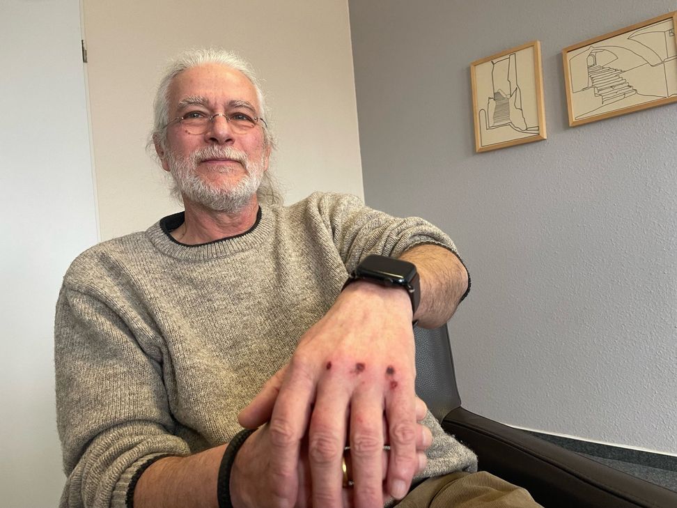 An Hand, Bein und Fuß leicht verletzt: Rechtsanwalt Hans Bleck (Foto). Einen Tag nach dem Schreck sagt er schon wieder lachend: „Wir hatten Glück.“